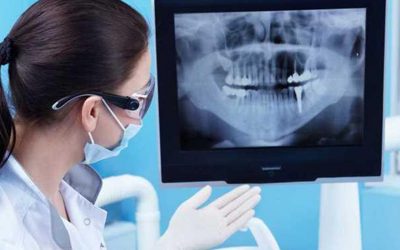 5 Things To Expect If You Haven’t Been To The Dentist In Years