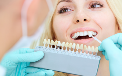 Dental Veneers: Ten Facts to Know